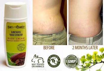 

Free Shipping Effective Natural Body Cream Against Stretch Marks SAFLORA 100 ml / 3.4 oz