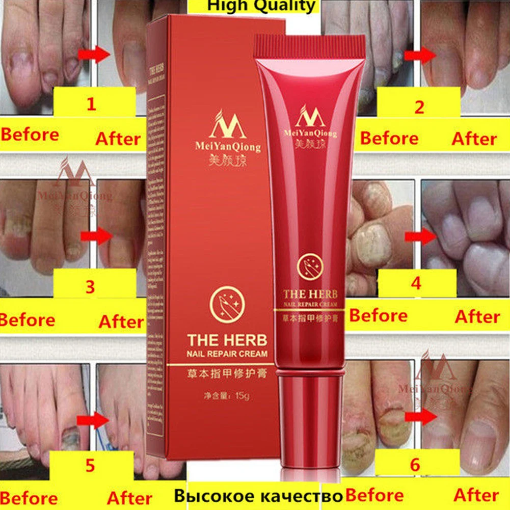 Nail Repair Cream Nourishing Herb Fingernail Care Treatment Recovery Makeup