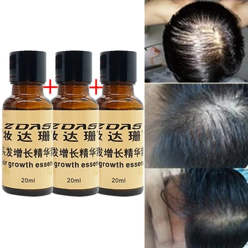 

Hair Loss Product Natural With No Side Effects Grow Hair Faster Regrowth Hair Growth serum Restoration Thickening Fibers 3 pcs