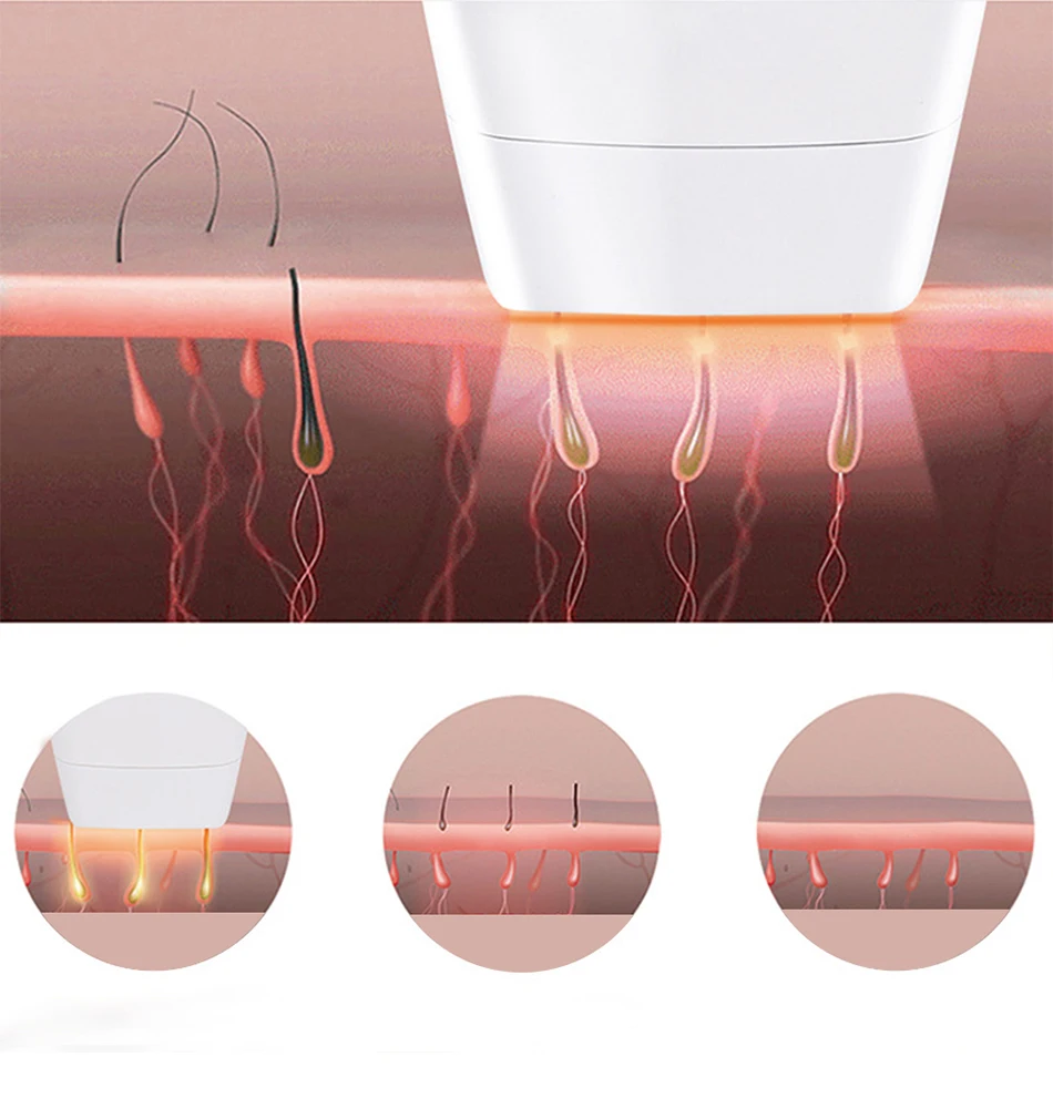 5 режимов яркий пульсирующий свет IPL эпилятор электрический тела, лица лазер для удаления волос Для женщин безболезненно Threading машины