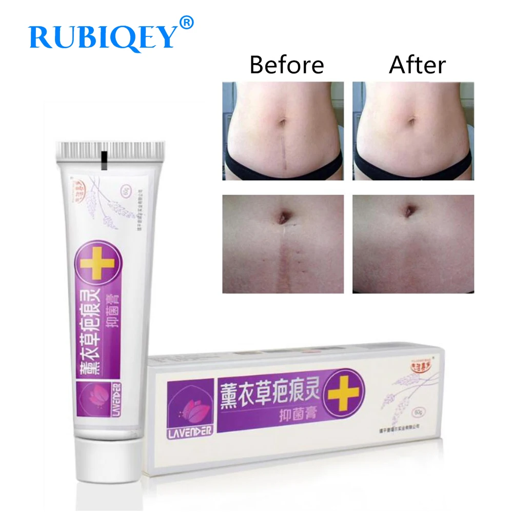

Lavender Herbal Repair Cream Stretch Mark Cream Remove Scars Relieve Acne Body Scars Repair Serum Moisturizing Whitening RUBIQEY