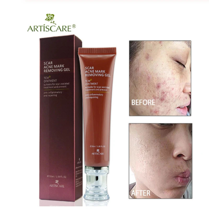 

ARTISCARE Scar Acne Mark Removing Gel TCM Blackhead Treatment Whitening Skin Care Makes Repair Skin Soft Smooth Face Cream