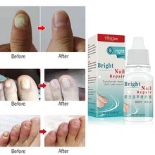 10ML Nail Treatments Moisturizing Nail Polish Onychomycosis Nail Repair Liquid Nourishing Liquid Armor Sterilization TSLM1