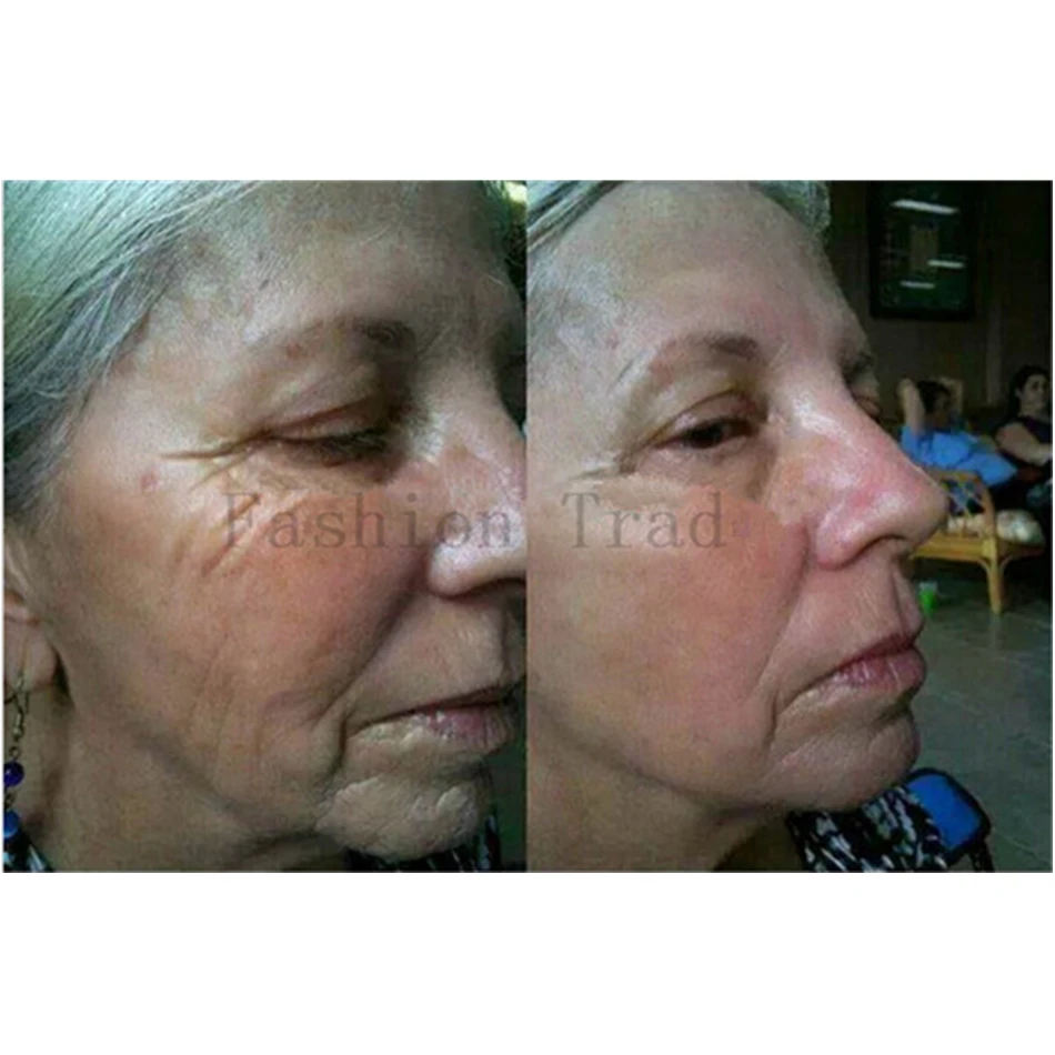 

2pcs Hyaluronic acid Essence liquid Anti Aging cream Face Lift Serum Skin Care Product Argireline liquid Powerful Anti-wrinkle