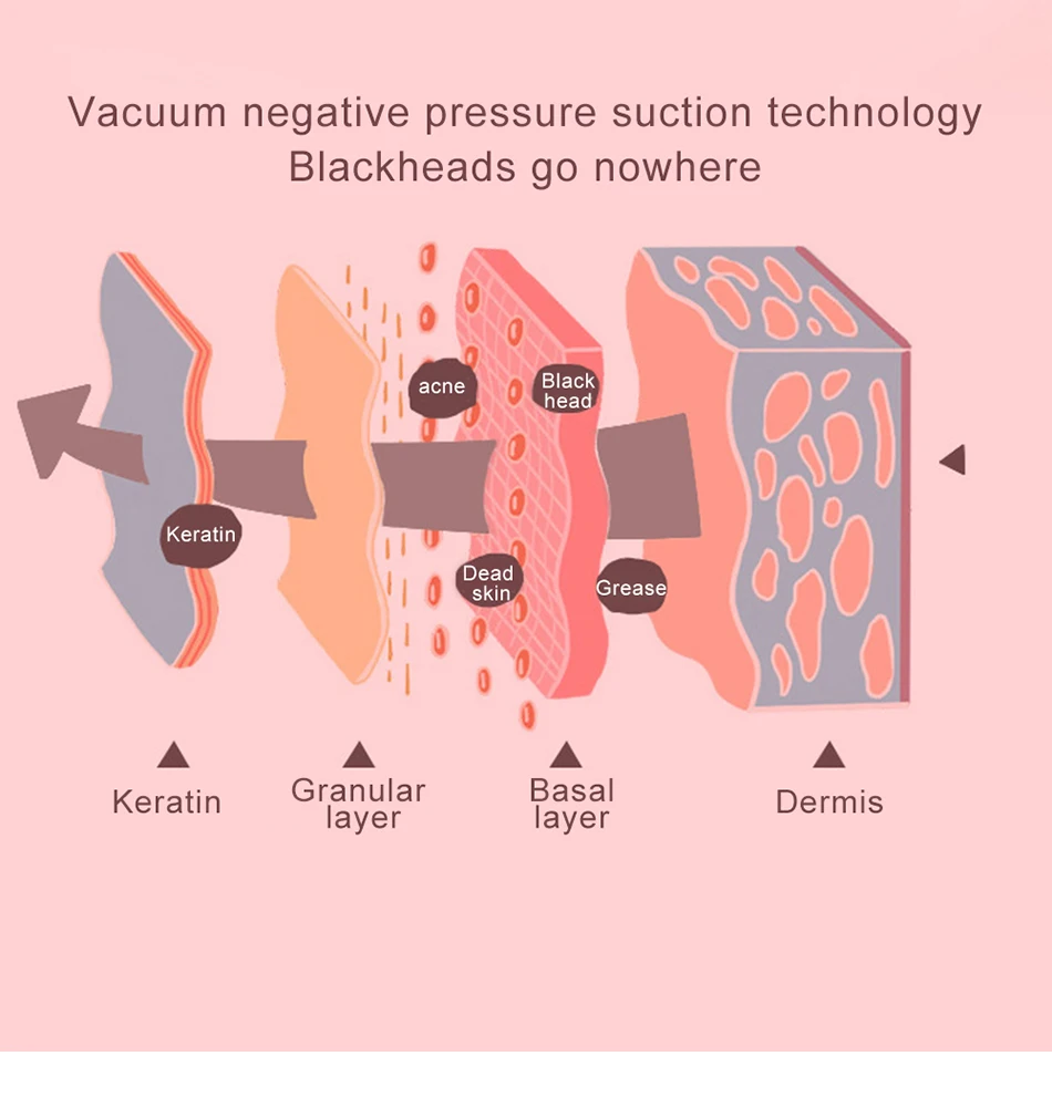 Очиститель пор, угревая сыпь, экстрактор для удаления прыщей, удаление черных точек, вакуумное всасывание пор, средство для очистки лица, черные точки
