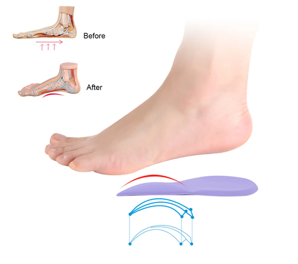 Ортез под пятку. Подошвенный фасциит стельки. Пелот ортопедический переднего отдела стопы. Стельки-супинаторы strutz 2шт. Стельки из эва.