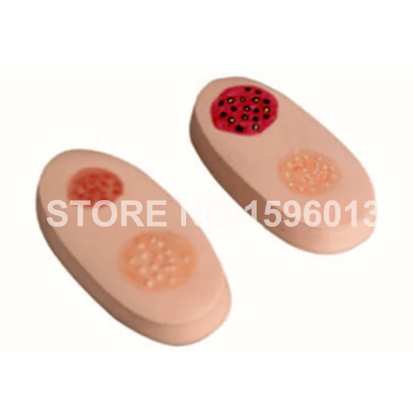 Vivid Variola Lesion Modules, Smallpox Simulator модель кожи, Variola pathology изменения модель ухода