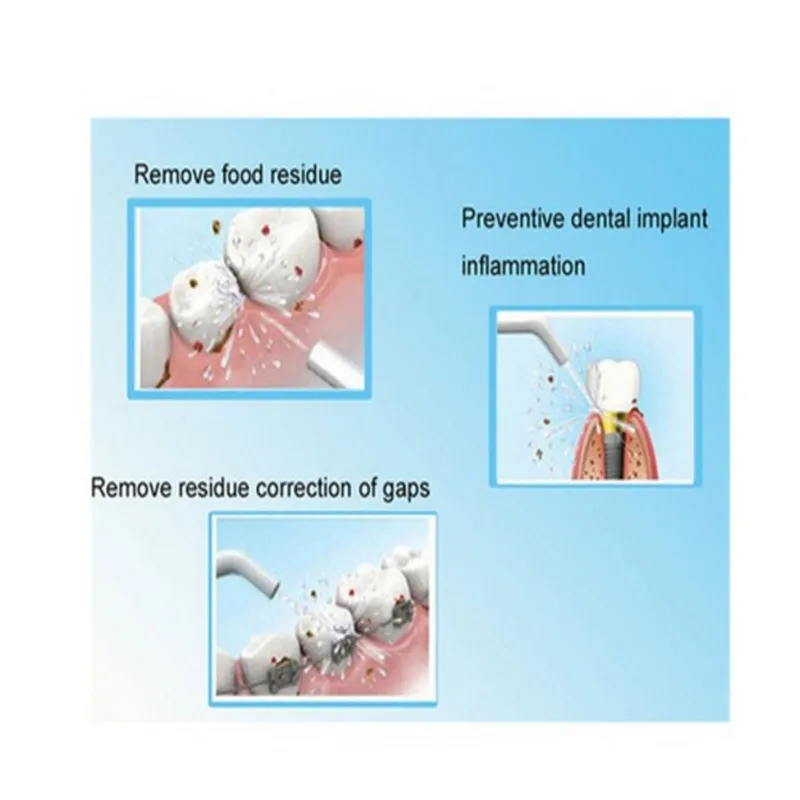 Портативная мощная зубная нить, струя воды, шнуры, устройство для чистки зубов, эффективная долговечная машина для отбеливания зубов, инструменты для ухода за зубами