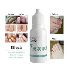 Профессиональный Nail обработки жидких ногтей Питание Нефть противогрибковые ногтей ремонт Яркий палец гриб удаления по уходу за ногами D7