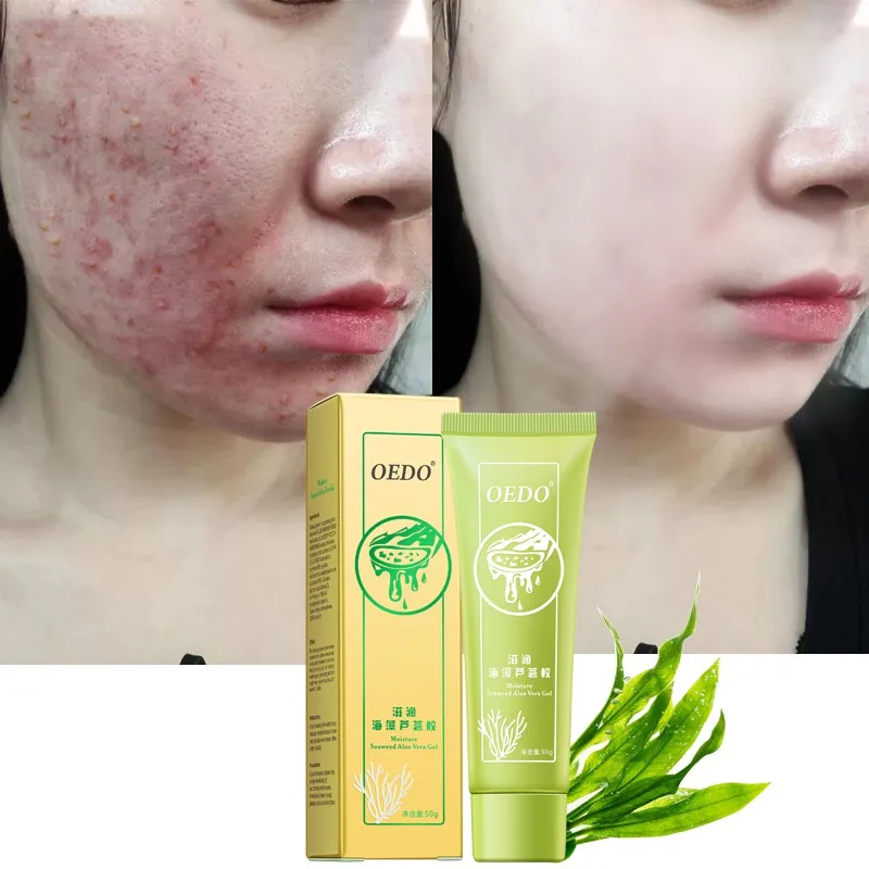 

Aloe Vera Gel Hydrating Whitening Cream Acne Anti Aging Wrinkle Collagen Whitening Face Cream Brighten Skin Care