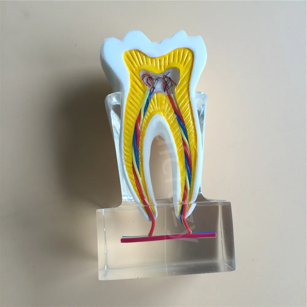 Dental Anatomical Molar Model molar inner structure with nerves and vessels Teeth 2018 | Красота и здоровье