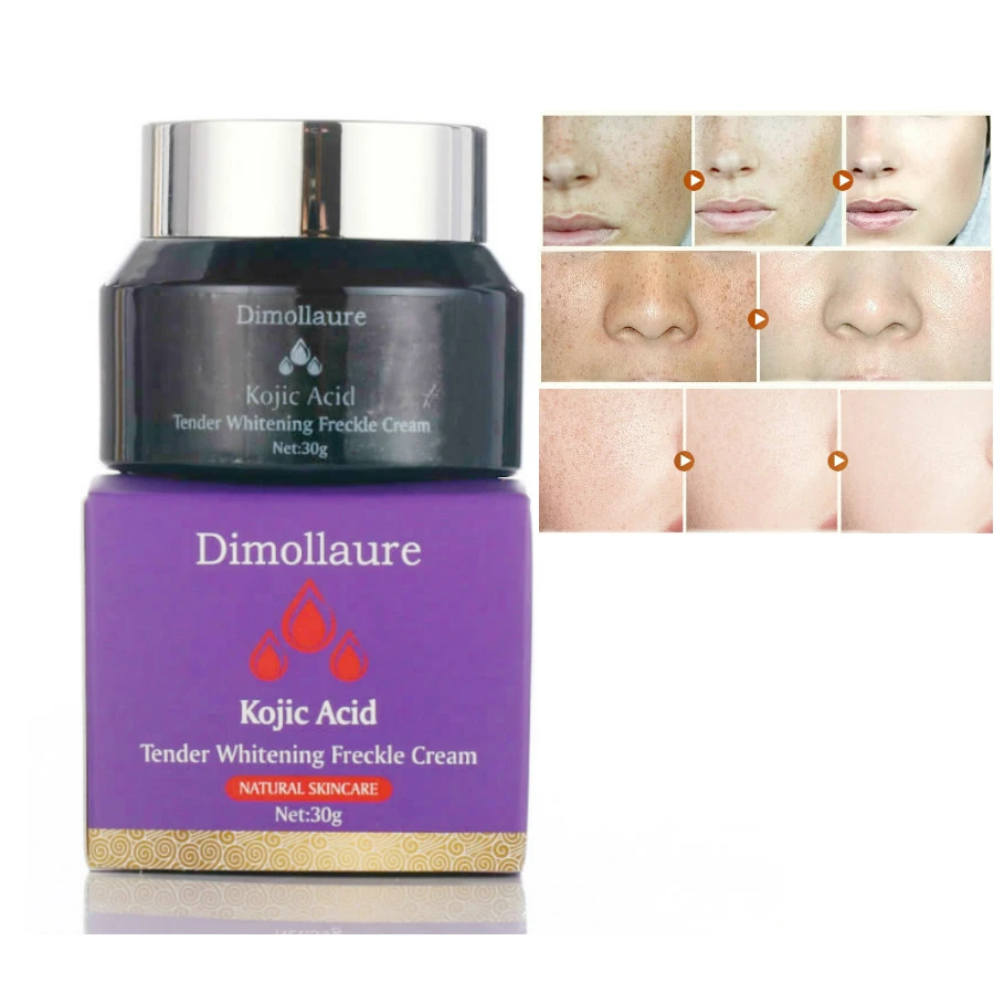 Buy Dimollaure Kojic Acid whitening cream 30g Retinol