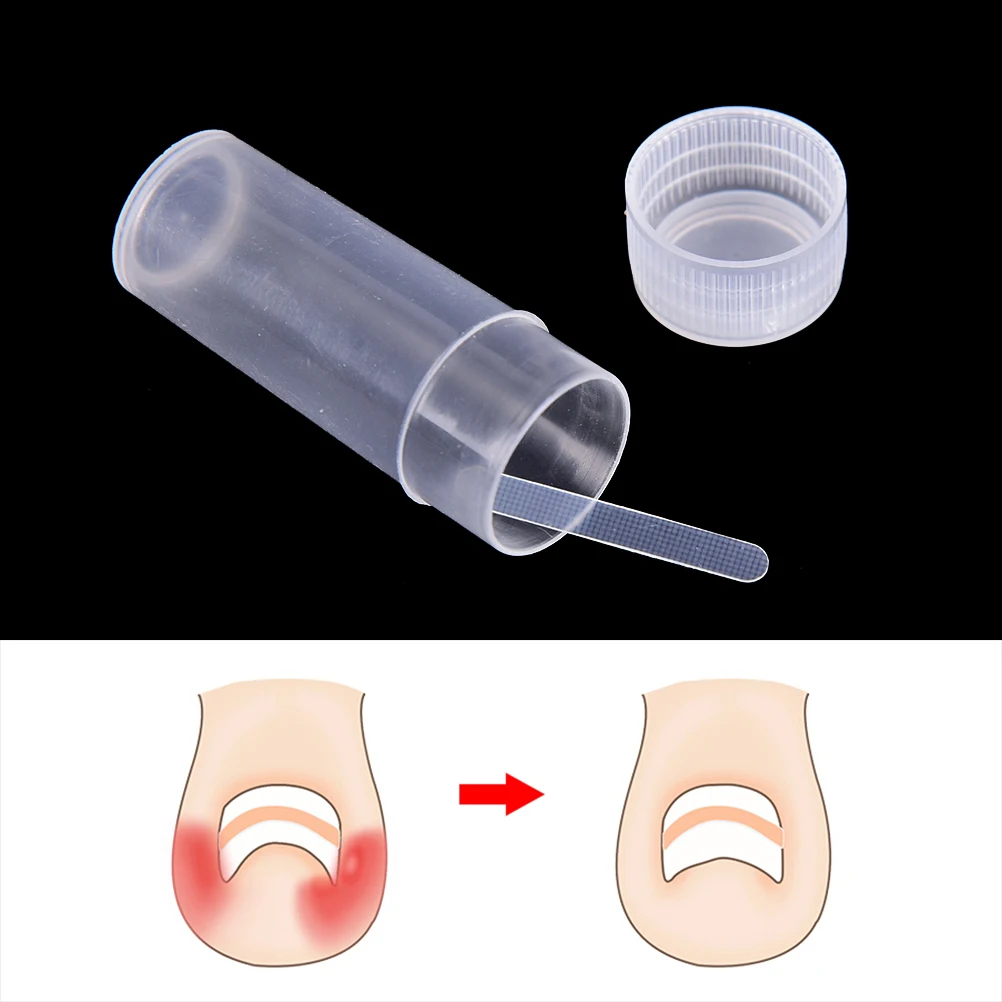 

Toe Nail Paronychia Sticker Correction Ingrown Patch Acronyx Wire Foot File Care Tool Corrector