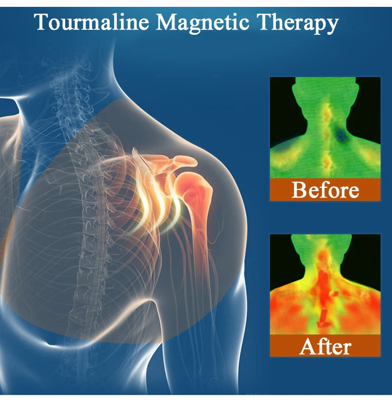 Youhekang САМОНАГРЕВАЮЩАЯСЯ плечевая Поддержка Brace периартрит Корректор осанки для магнитной терапии обезболивающая поддержка спины