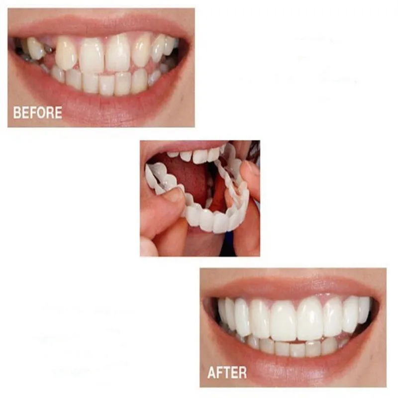 Отбеливание зубов, зубная крышка, зубная скобка, виниры, один размер, подходит для большинства удобных зубных протезов, уход за ложными зубными зубами
