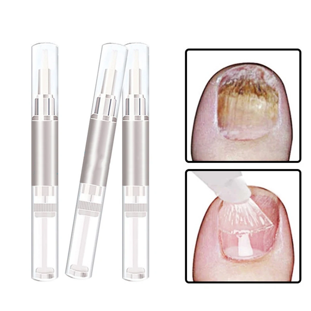 1Pcs 3ml Fungus Treatment Pen Antifungal Infection Organisms Nutrient Liquid Manicure Repair Solution To Gray Nail Liquid