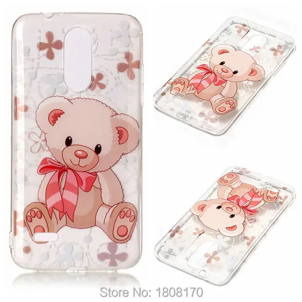 27895 LG K4 2017 K8 2017 K10 2017 LG G6 6S P10PLUS Y5 2017 Z981TPU (4)
