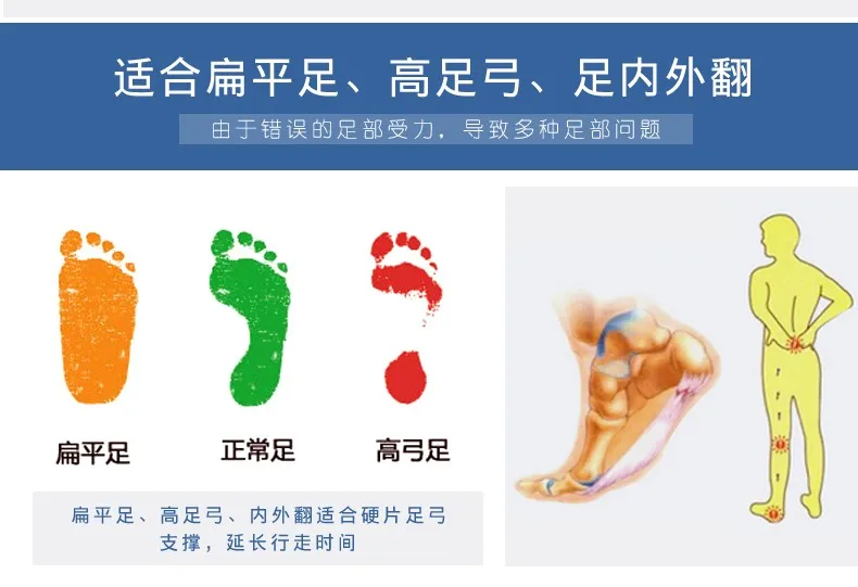 Flat Arch Foot Orthopedic X-Leg 8-Shaped Legs Correction Shoe Insole Heel Arch Support Insoles Sheepskin Leather Orthotics 39-44 (8)