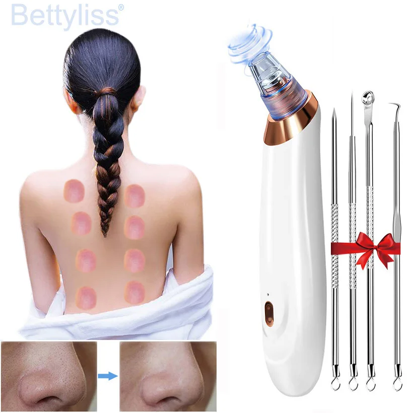

Vacuum Blackhead Remover Beauty Extractor Facial Acne Whitehead Pimple Pore Nose Face Cleanser Tool Device