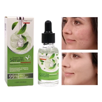 

Face 34ml Tea Tree Essential Oil Anti-wrinkle Extract Acne Removal Scars Marks Treatment