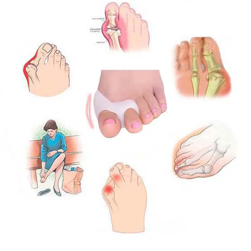 2pcs=1Pair Gel Foot Care Tool Bunion Corrector Bone Big Toe Protector Hallux Valgus Straightener Toe Spreader Pedicure 2pcs=1Pair Gel Foot Care Tool Bunion Corrector Bone Big Toe Protector Hallux Valgus Straightener Toe Spreader Pedicure