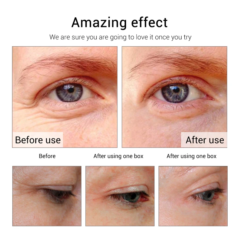 EFERO Collagen Eye Mask Eye Patches Under Eyes Pad Dark Circles Removal Anti Aging Moisturizing Eye Masks Gel Sleep Patches