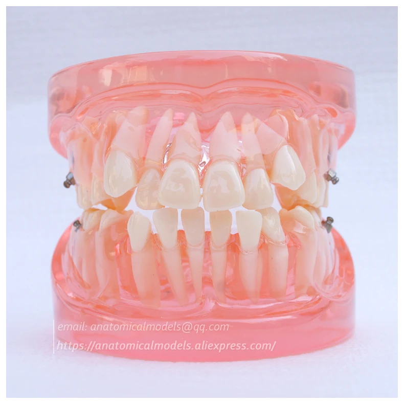 13022 DH202 Orthodontic Model 2 