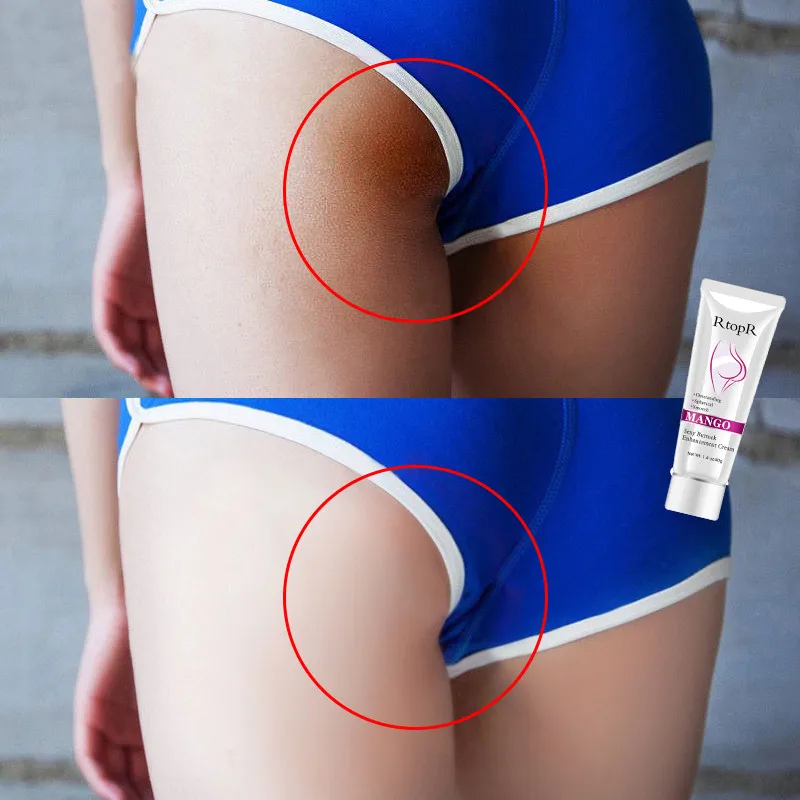 Mango Sexy Buttock Enhancement Cream Improves Back And Leg Pain Eliminate Printing And Firming buttock Effective Shape Hip Curve