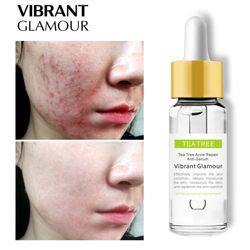 

VIBRANT GLAMOUR Tea Tree Repair Face Serum Acne Scar Shrink Pores Eliminates Acne Treatment Oil Control Essence Face Serum TSLM2