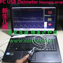 USB и уровня кислорода в крови на базе PC пульса и уровня кислорода в крови SpO2 монитор usb зонд(1 кабель+ 1 кабель для новорожденных сенсор) 24 часа наблюдения