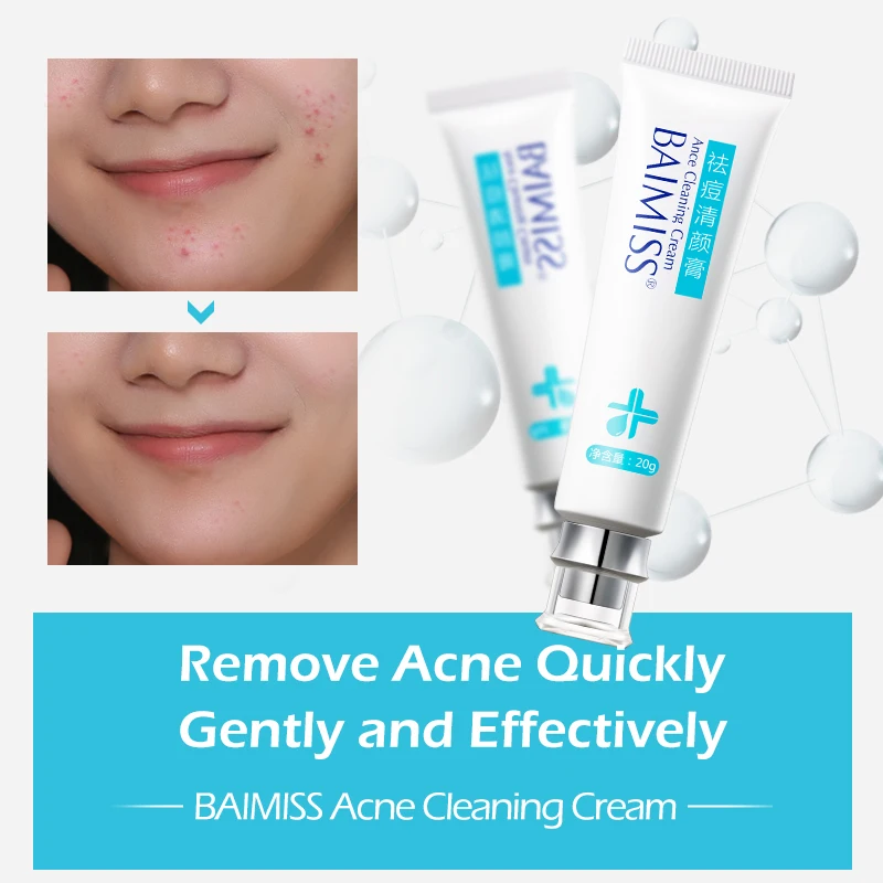 מוצר BAIMISS Acne Cleaning Cream Skin Care Remove Repair Comedone