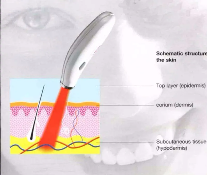 Acne treatment