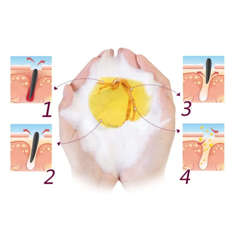 Женьшень Восстанавливающий туалетное мыло глубокий очиститель мыло псориаз экзема противогрибковый для ванной отбеливающий SoapS1
