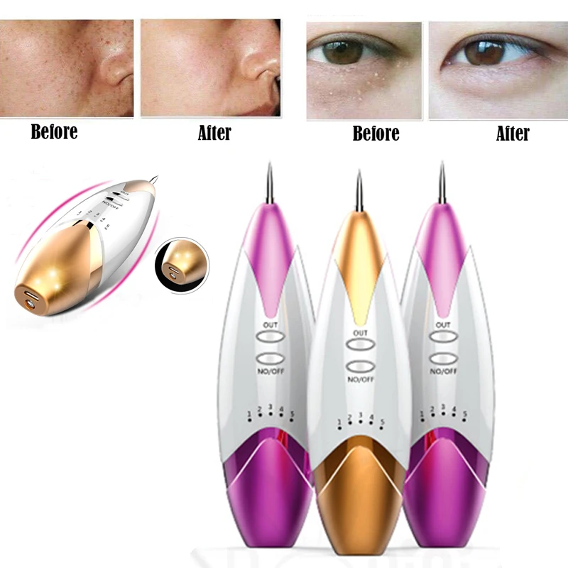 

Portable Laser Dark Spot Removal Pen Mole Freckle Removal Machine Laser For Tattoo Removal Beauty Instrument Dot Mole Spot Pen