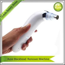 Portable Pigment Dead Skin Acne Blackhead Pores Callus Removal Electric Diamond Microdermabrasion Peeling Skin Lifting Equipment