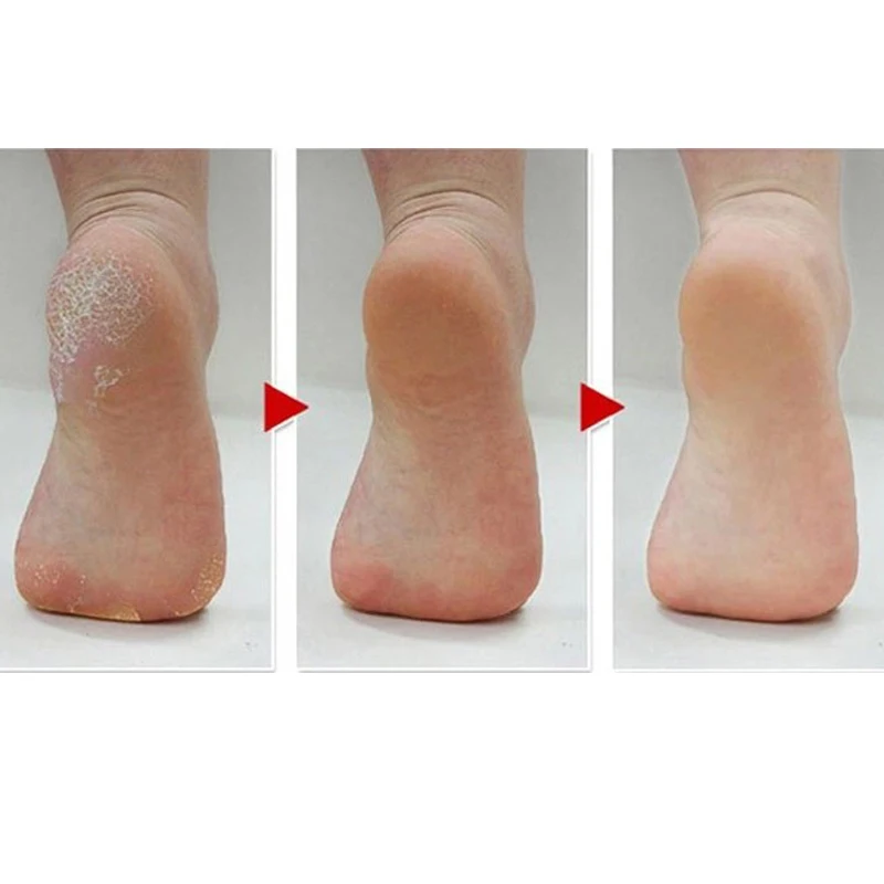 Электрический пилинг для ног rasp callus remover Педикюр шлифовальный станок удаления