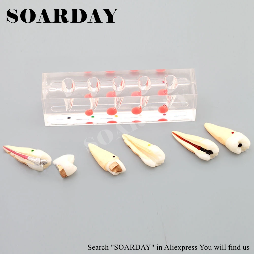 Endodontic Model (2)