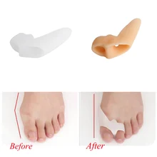 1 пара Силиконовый разделитель пальцев ног корректор ног специальный вальгусный велосипед большого пальца ортопедические подтяжки ноги забота инструменты