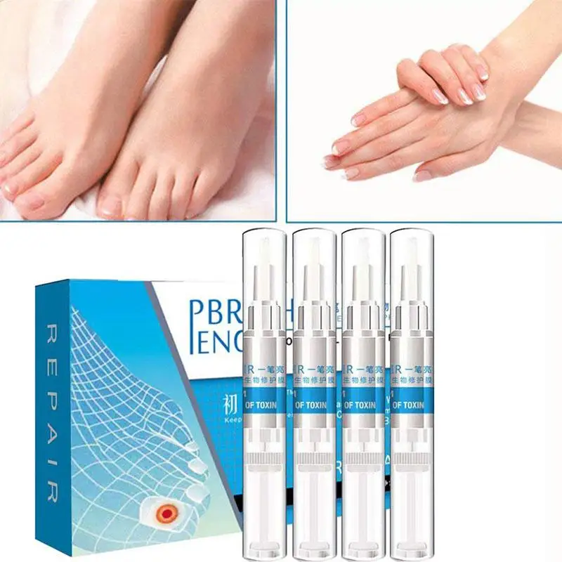 Toenail Fungus Treatment Toenail Antifungal Care Nail Fungus Treatment Pen Fungal Nail Gel Toenail Fungus Treatment Toenail Antifungal Care Nail Fungus Treatment Pen Fungal Nail Gel