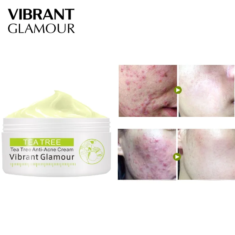 

Tea Tree Anti-acne Face Cream Acne Scar Cream Shrink Pores Facial Eliminates Acnes Cream Skin Care Face Cream for Face TSLM2