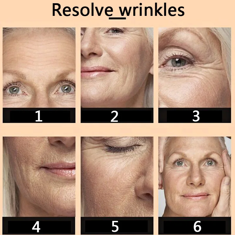 Cross linked Wrinkle filler HA hyaluronic acid for anti wrinkle Beauty whitening skin face lifting injection pen 8ml 10ml 1:1 mi