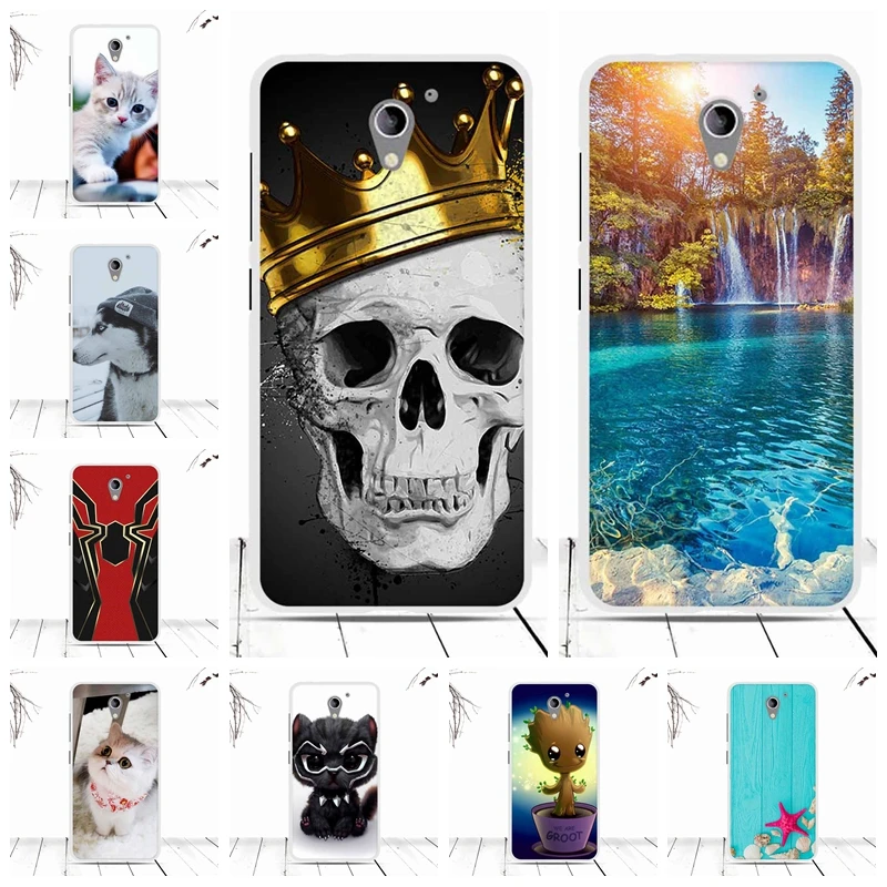 

Phone Case For ZTE Blade A510 BA510 Case Cover Luxury Soft TPU Silicone Back Cover For ZTE Blade A510 BA510 Cover Fundas Coque
