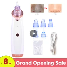 Инструмент для удаления чёрных точек прыщи, акне удаление угрей вакуум средства по уходу за кожей очищает поры лица аппарат для алмазной дермабразии