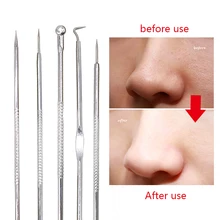 7style Blackhead Extractor Black Dots Cleaner Acne Blemish Remover Needles Set Black Spots Pore Cleanser Tool Comedone Extractor
