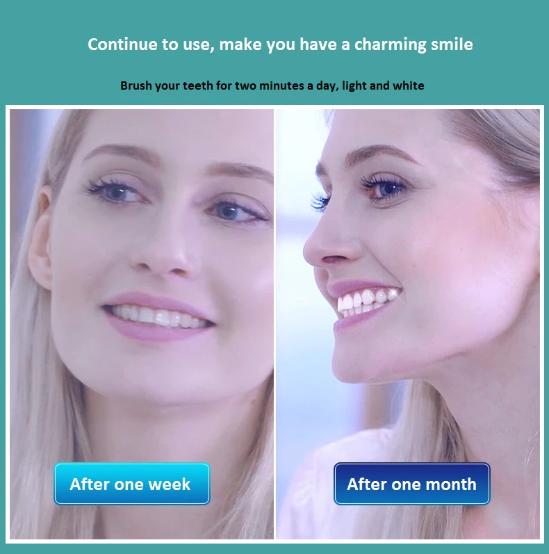 HTB1W339igvD8KJjy0Flq6ygBFXaB