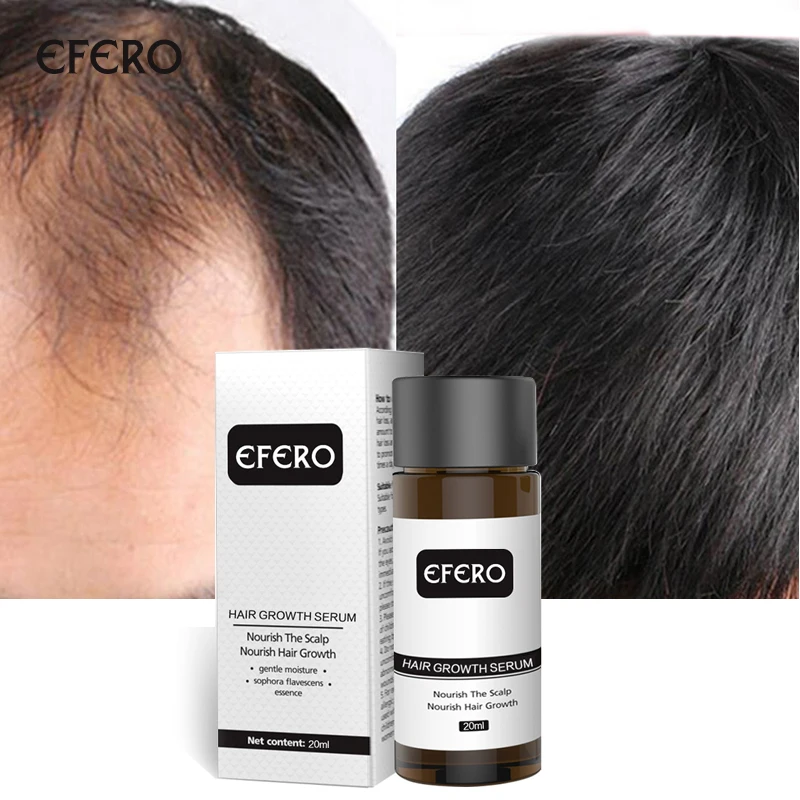 EFERO 1 шт. мощная Сыворотка от выпадения волос Эссенция от выпадения волос эфирное масло более толстый рост волос предотвращает облысение продуктов