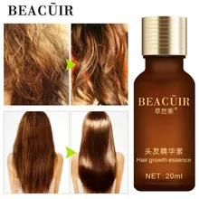 BEACUIR Новое быстрое мощное средство для роста волос продукты Эфирное Масло жидкое лечение предупреждающий потерю волос уход за волосами Andrea