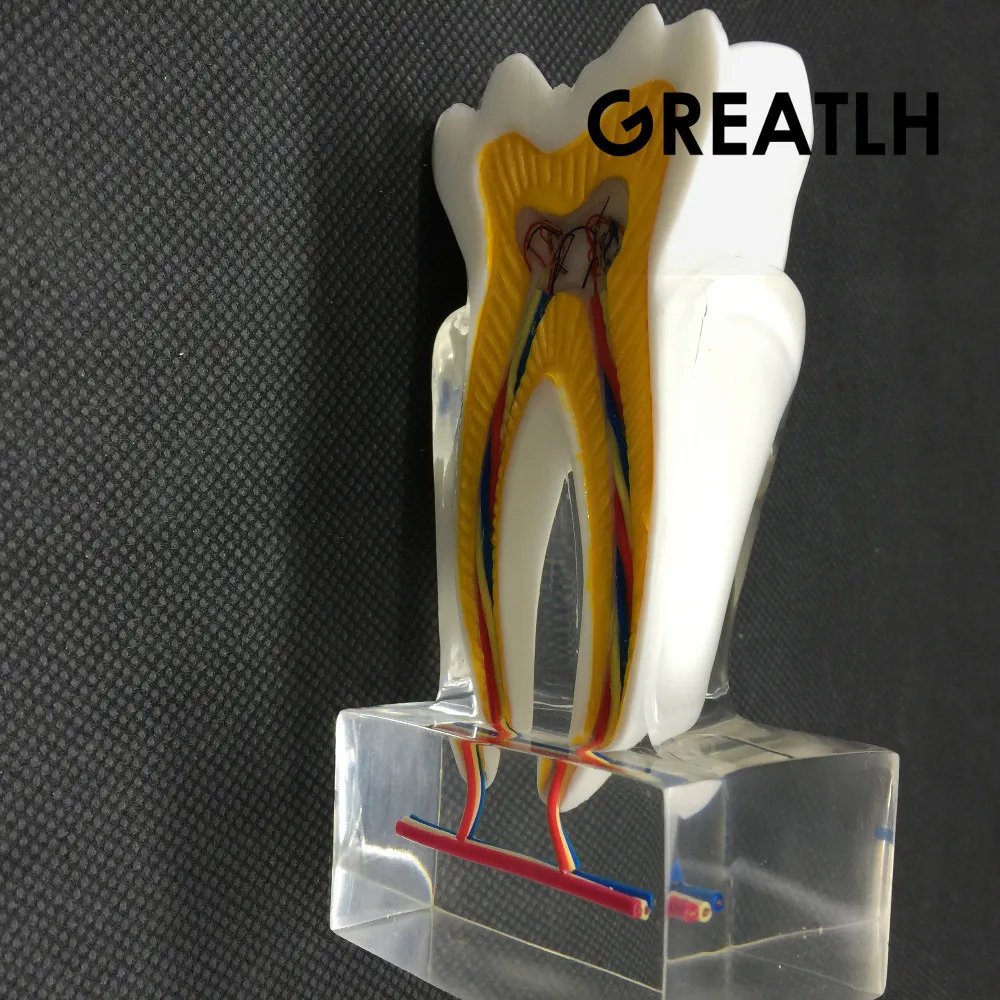 Dental Anatomical Molar Model 2017 molar inner structure with nerves and vessels