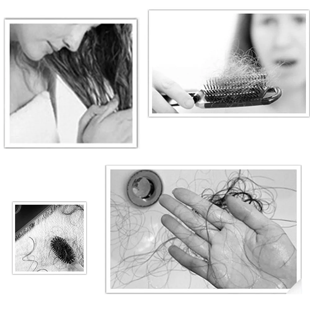 30 мл средство для роста волос Advanced истончение волос и выпадение волос дополнение предотвратить выпадение продуктов волос сыворотка для роста
