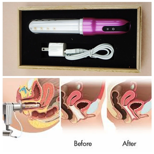 Can you get infections from vibrator Fisting stretching dildos